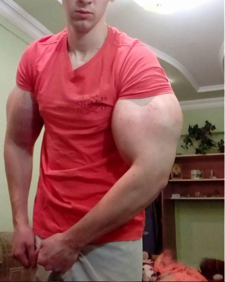 Kol kası yapmak için ölümü göze almıştı! Bu kez de... G4