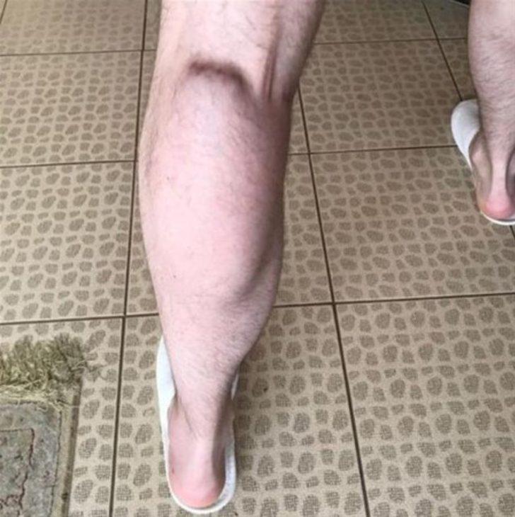 Kol kası yapmak için ölümü göze almıştı! Bu kez de... G5