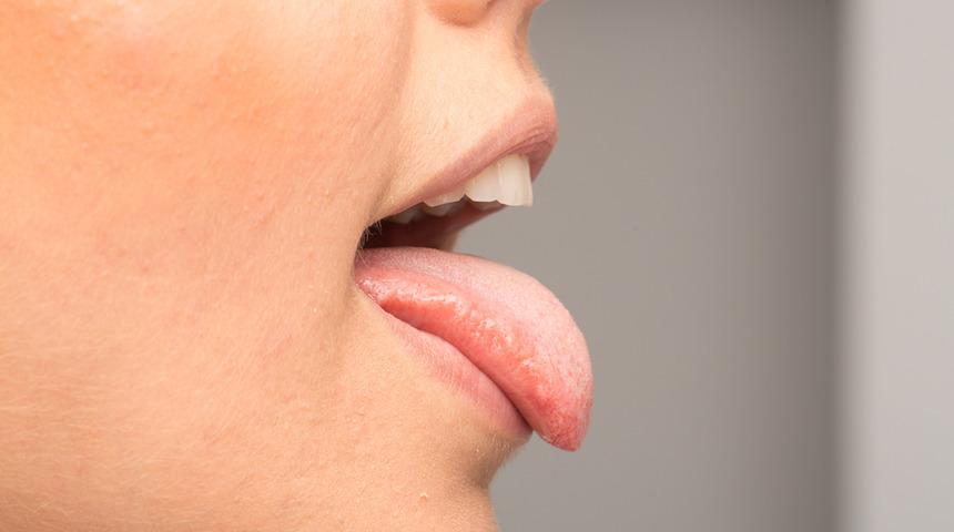 Tükürük bezi tümörü belirtisi nedir? Tükürük bezi tümörü neden olur? Tükürük bezi tümörü tedavisi için ne yapmalı?