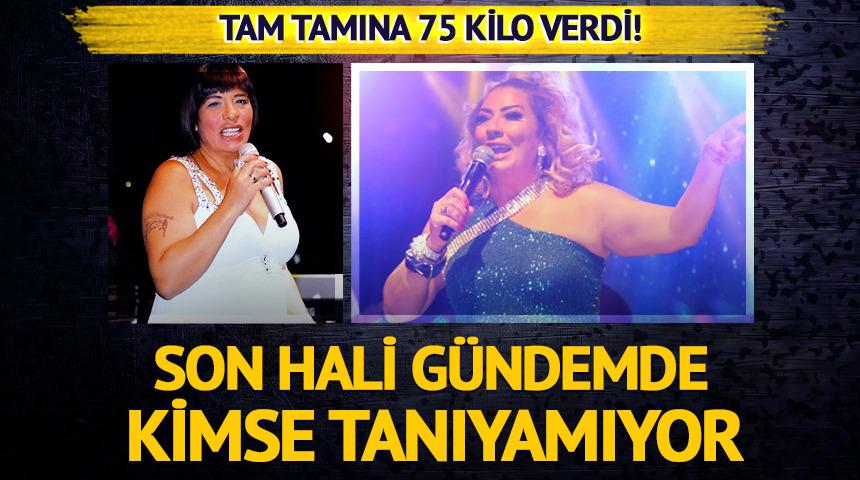 Son haliyle yine g&uuml;ndemde! Kimse tanıyamıyor