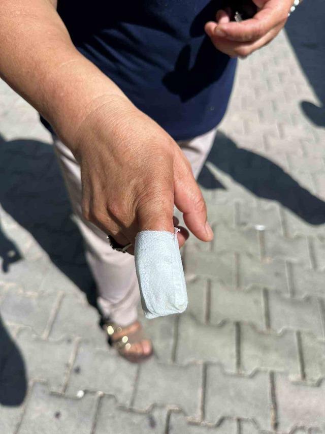 İzmir’de pitbull saldırısı: 5 çocuk annesi kadının parmağı koptu 5
