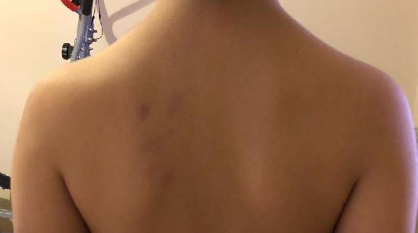 Bağcılar'da 6 yaşındaki kız çocuğuna okulda darp iddiası!