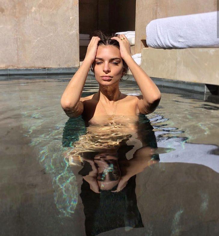 Instagram'ın yeni trendi: Başım ağrıyor G4