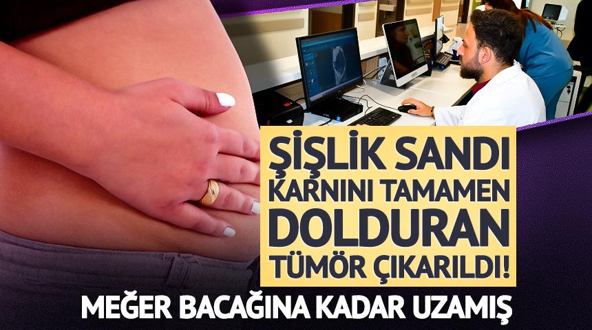 Şişlik sandı karnını tamamen dolduran t&uuml;m&ouml;r &ccedil;ıkarıldı! Meğer bacağına kadar uzamış