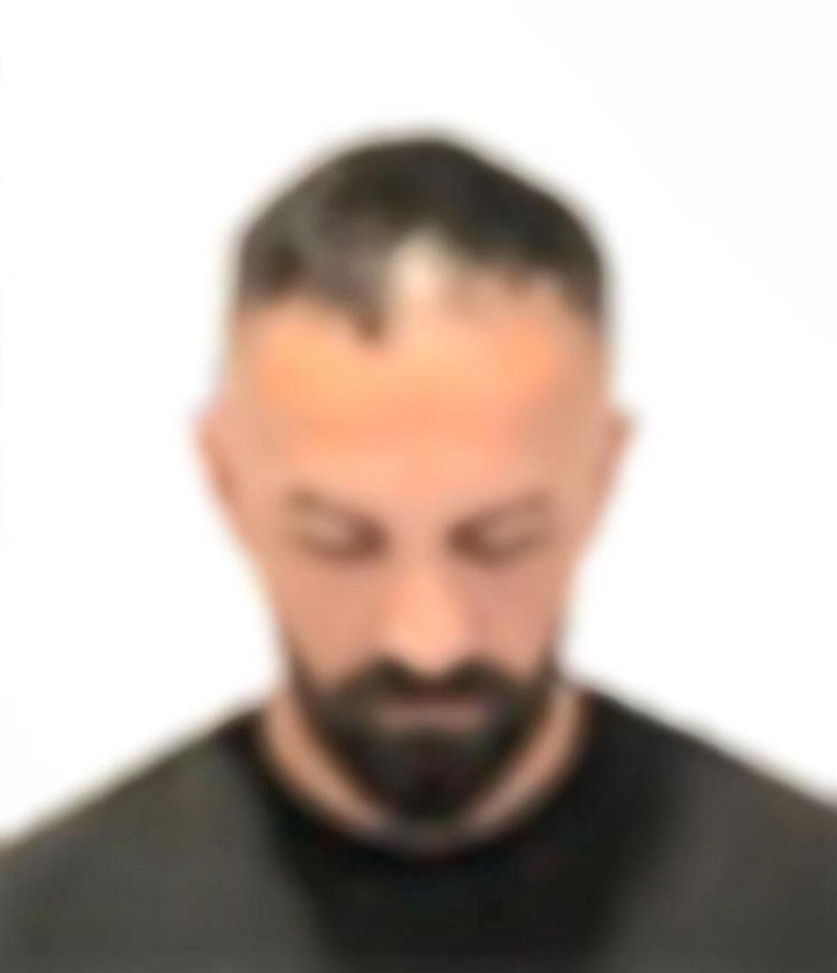 G&uuml;zellik merkezindeki skandalda yeni gelişme! 1 ş&uuml;pheli daha g&ouml;zaltına alındı 3