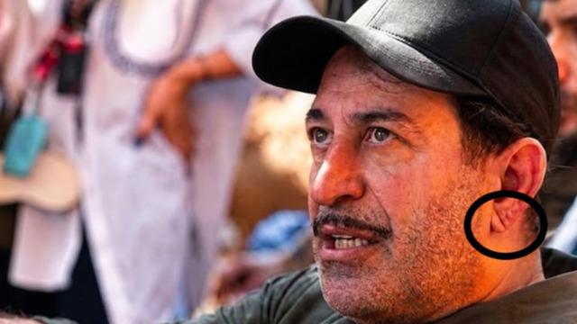 Cem Yılmaz'ın kulak memesindeki çizgi konuşuluyor! Kalp krizinin habercisi mi?