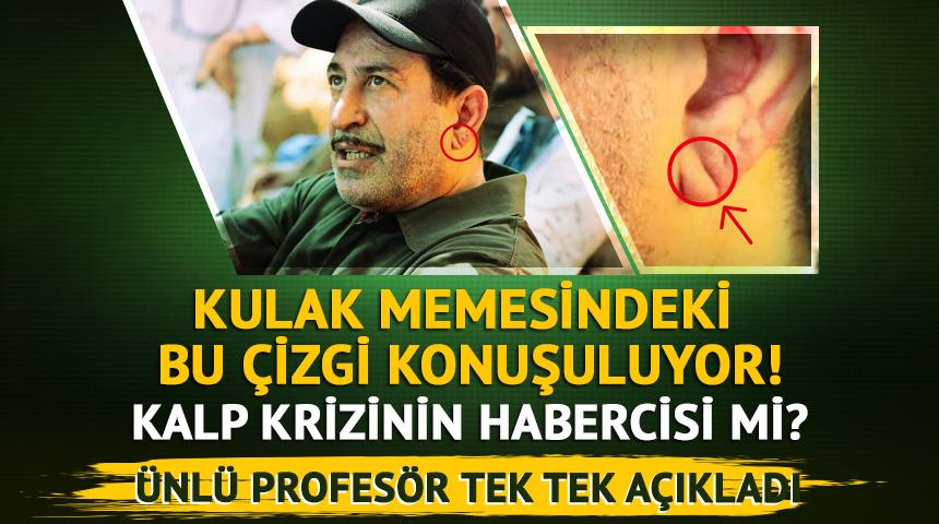 Kulak memesindeki &ccedil;izgi konuşuluyor! Kalp krizinin habercisi mi?