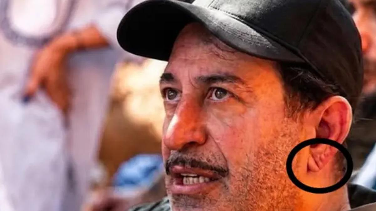 Cem Yılmaz ın kalp krizi sonrası gündem olan detay: Dul bırakan damar ve Frank işareti nedir? 3