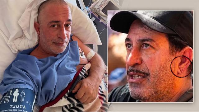 Cem Yılmaz'ın kalp krizi sonrası gündem olan detay: 'Dul bırakan damar' ve 'Frank işareti' nedir?