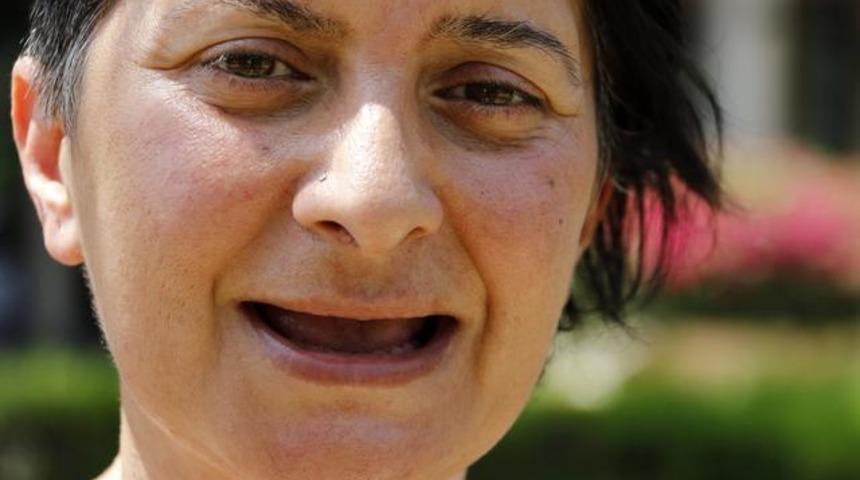 Tüm dişlerini kaybeden Sunay Öztürk Ankara'da tedaviye alındı