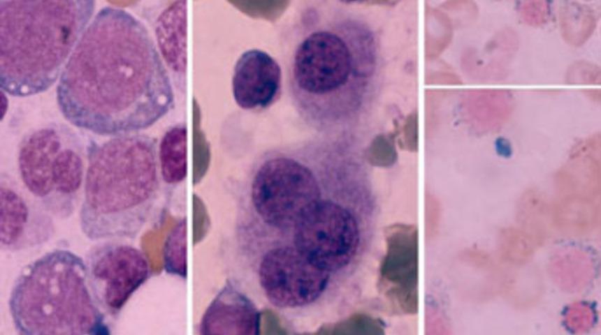 Kanserli hasta yakınları bilgilendirilecek...