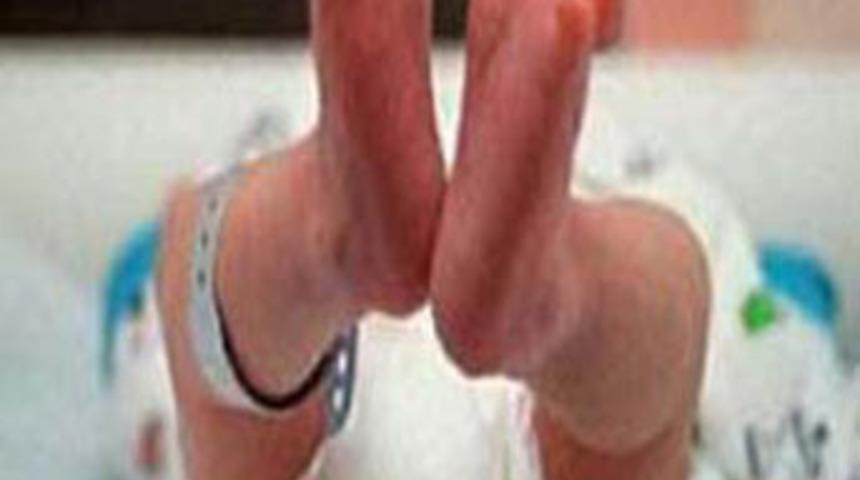 K&uuml;&ccedil;&uuml;k &ccedil;ocuğun &uuml;zerine kaynar su d&ouml;k&uuml;ld&uuml;