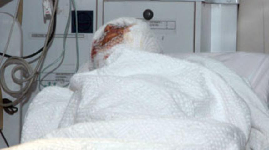 Kurt saldırısına uğrayan k&ouml;y karantinada