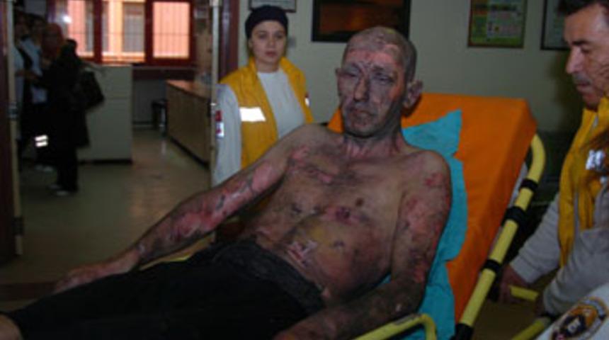 Al&uuml;minyum at&ouml;lyesinde patlama: 2 yaralı