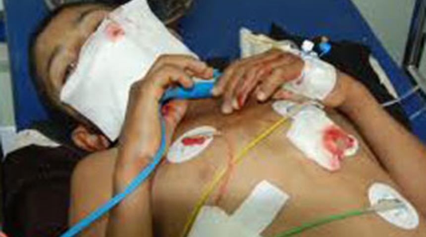 Bombaatar mermisi ellerinde patladı