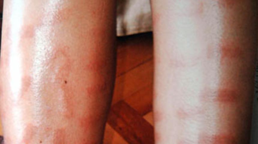 &quot;Az kaldı, sık dişini&quot; dedi, yaktı