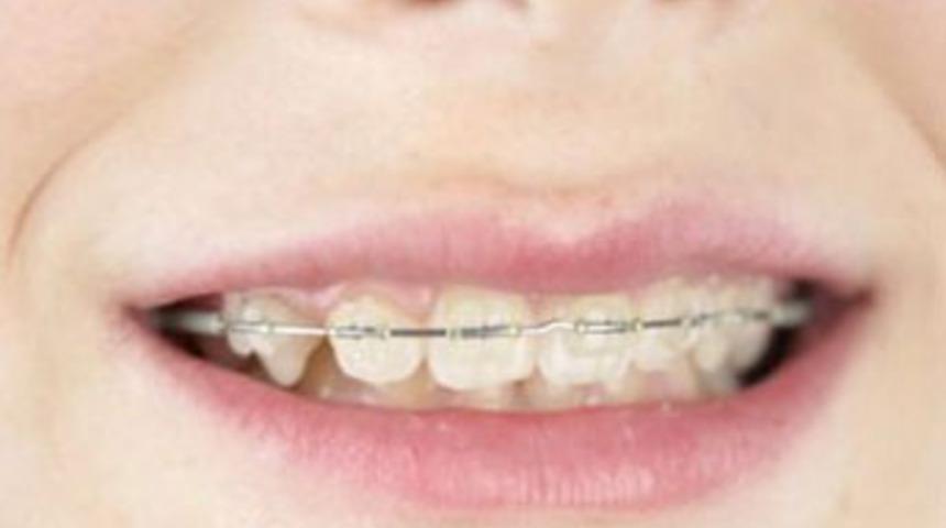 5 yıldır "ameliyat sırası" bekliyor