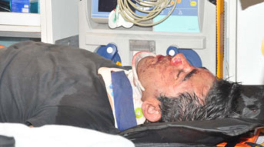 Hırsız, iş &uuml;st&uuml;ndeyken 5'inci kattan d&uuml;şt&uuml;