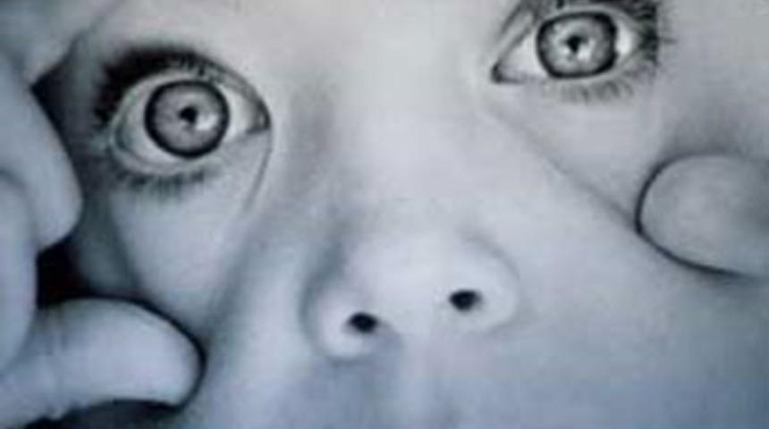 G&ouml;z tembelliğine dikkat