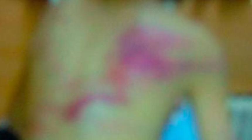 Babanın d&ouml;vd&uuml;ğ&uuml; &ccedil;ocuğa, devlet sapih &ccedil;ıktı