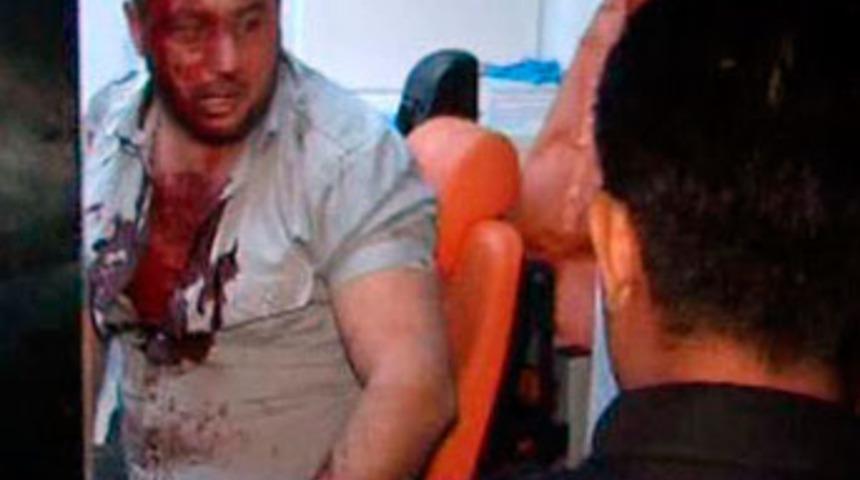 Taşlı sopalı kavga; 7 yaralı