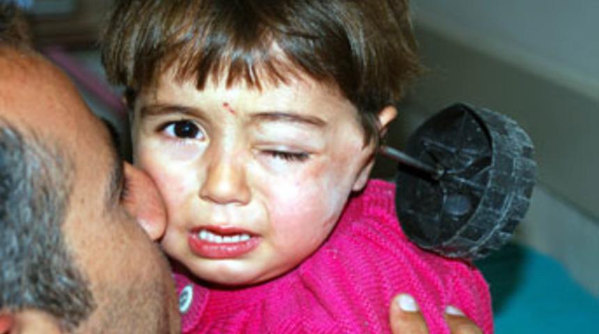 Başına demir &ccedil;ubuk saplandı