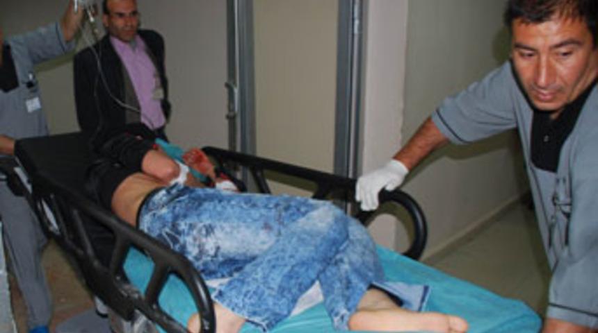 &Ccedil;ocukların kavgasında kan aktı