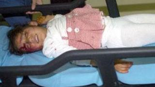 Başına televizyon düştü