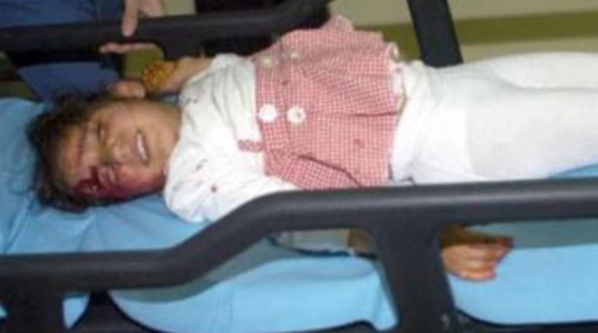 Başına televizyon düştü