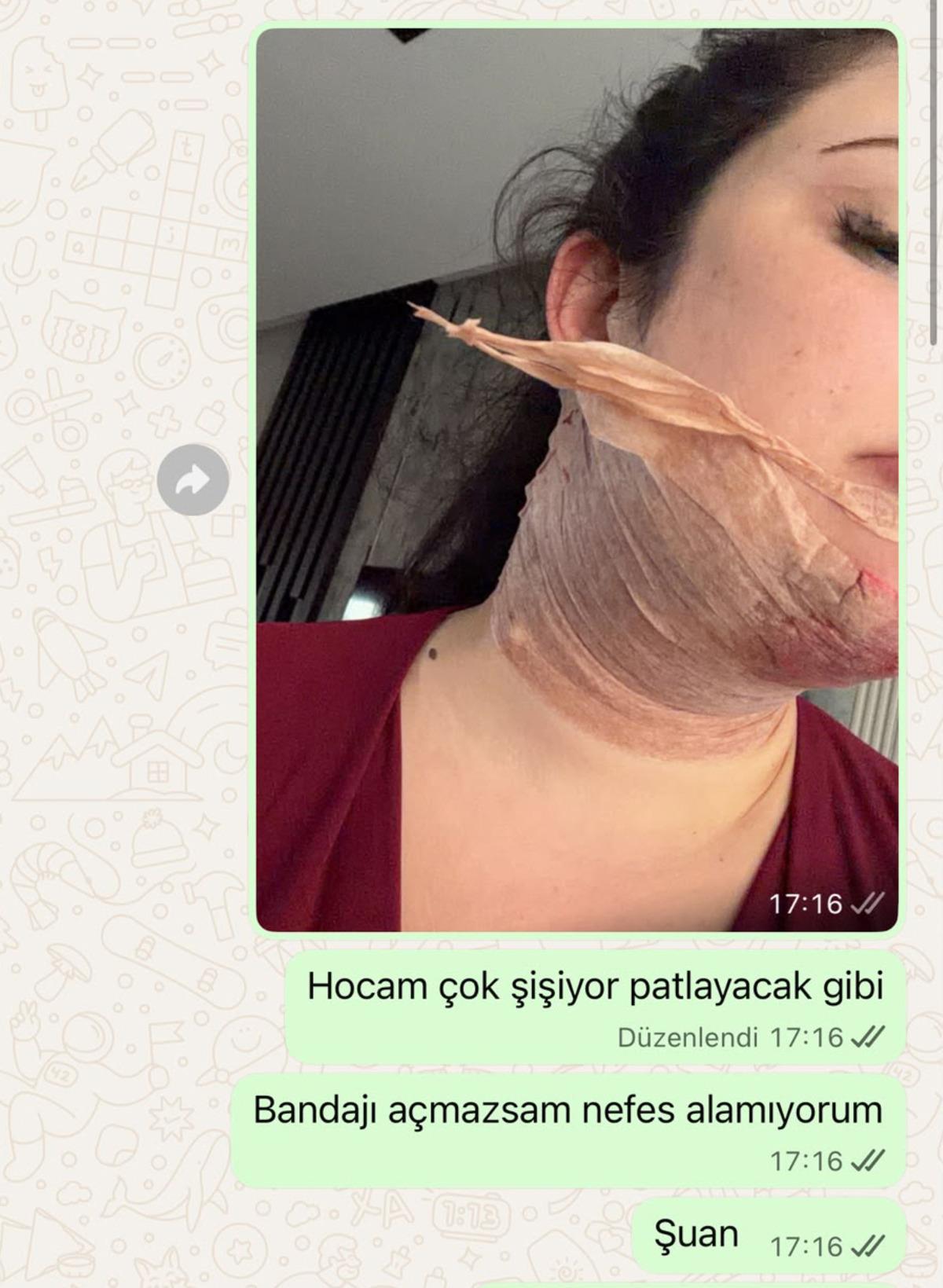 Estetik uğruna canından oluyordu! 2 gün süren ölüm kalım savaşı: "Yaşam mücadelem oldu" 2