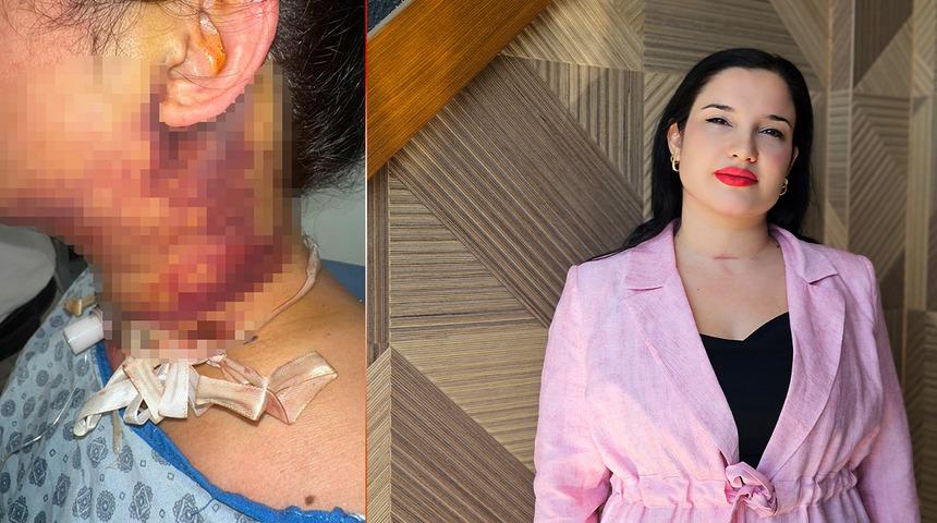 Estetik uğruna canından oluyordu! 2 g&uuml;n s&uuml;ren &ouml;l&uuml;m kalım savaşı: "Yaşam m&uuml;cadelem oldu"