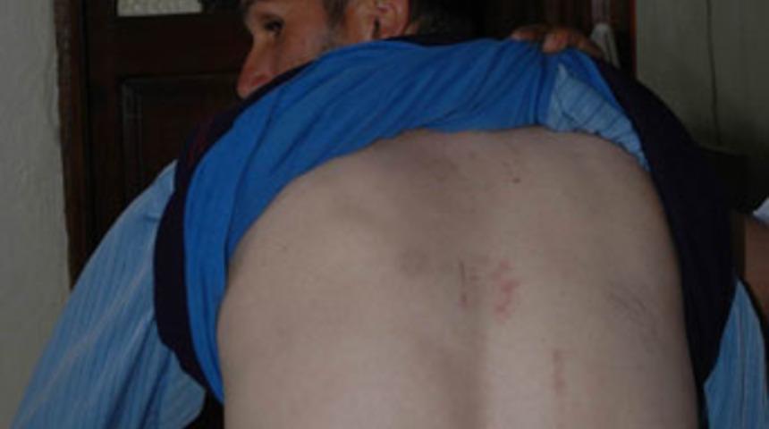 Koyun otlatan aileye polis dayağı iddiası