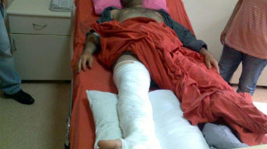 Karakolda işkence iddiası