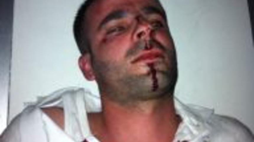 Polis esnafi hastanelik etti