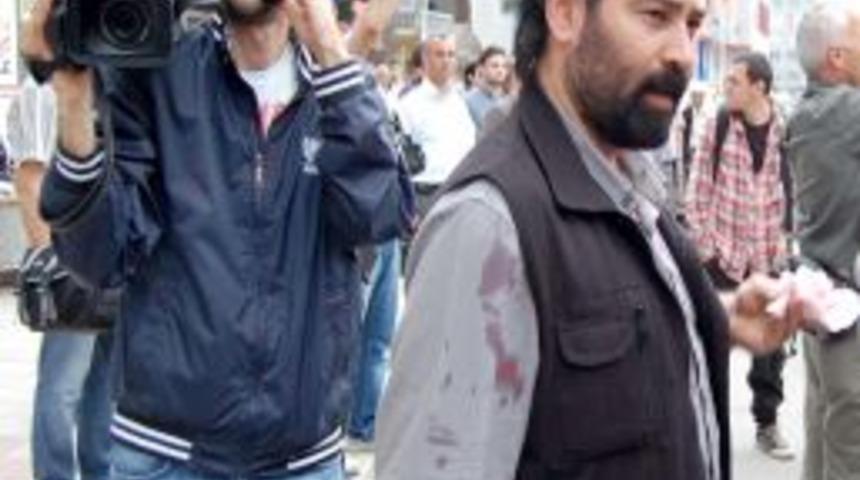 Samsun&rsquo;da ortaya &ccedil;ıkan Hopa provokasyoncuları bu kez gazetecileri hedef aldı