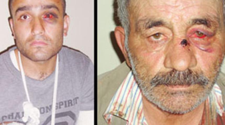 Karakolda dayak iddiası