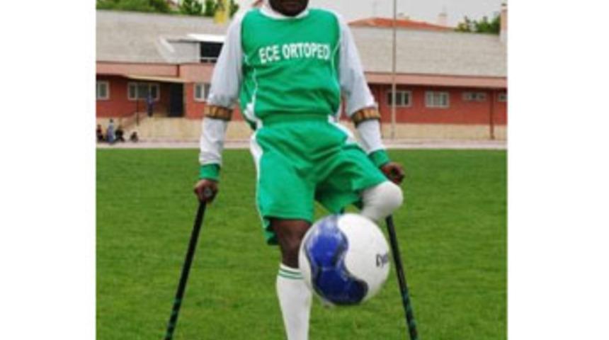 Protez bacak karşılığı transfer