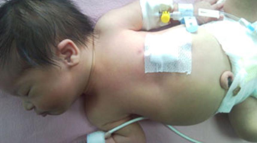 T&uuml;rkiye'nin en k&uuml;&ccedil;&uuml;k 'pilli bebeği'