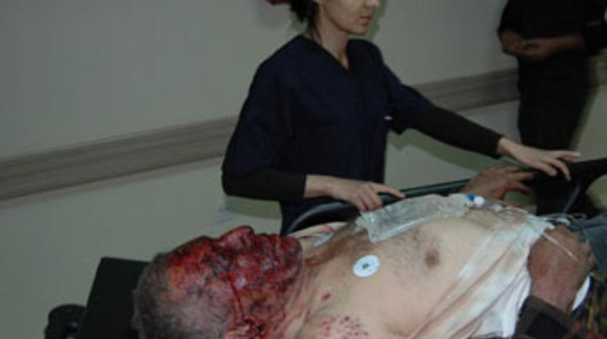 Dinamit ellerinde patladı