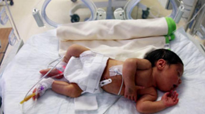 Omuriliği dışarıda doğan bebek hayata tutundu