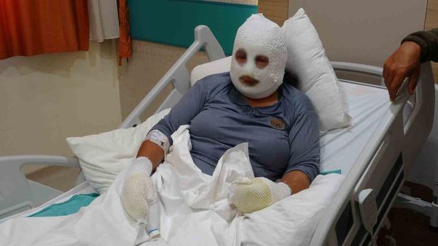 Kızını kurtarmak i&ccedil;in alevlerin arasına girdi, kendisi de yandı 3