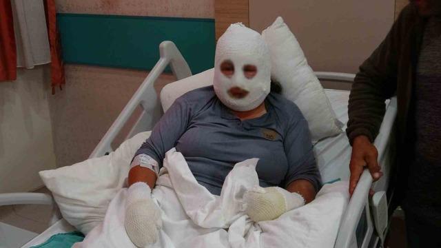 Kızını kurtarmak i&ccedil;in alevlerin arasına girdi, kendisi de yandı 2