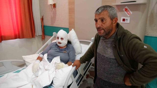 Kızını kurtarmak i&ccedil;in alevlerin arasına girdi, kendisi de yandı 1