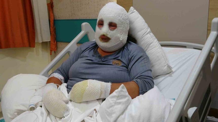 Kızını kurtarmak i&ccedil;in alevlerin arasına girdi, kendisi de yandı