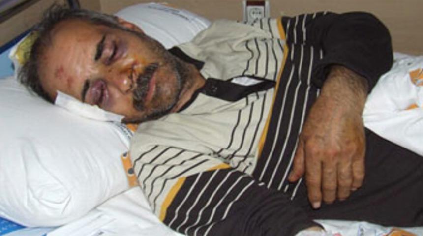 Tarla kavgasında işkence iddiası