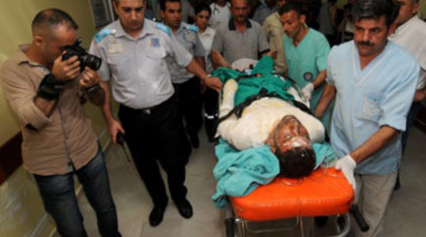 &Uuml;zerine benzin d&ouml;k&uuml;p yaktılar