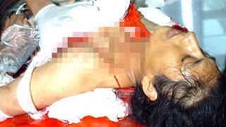 Ailesi sevgilisinden ayırınca kendini vurdu