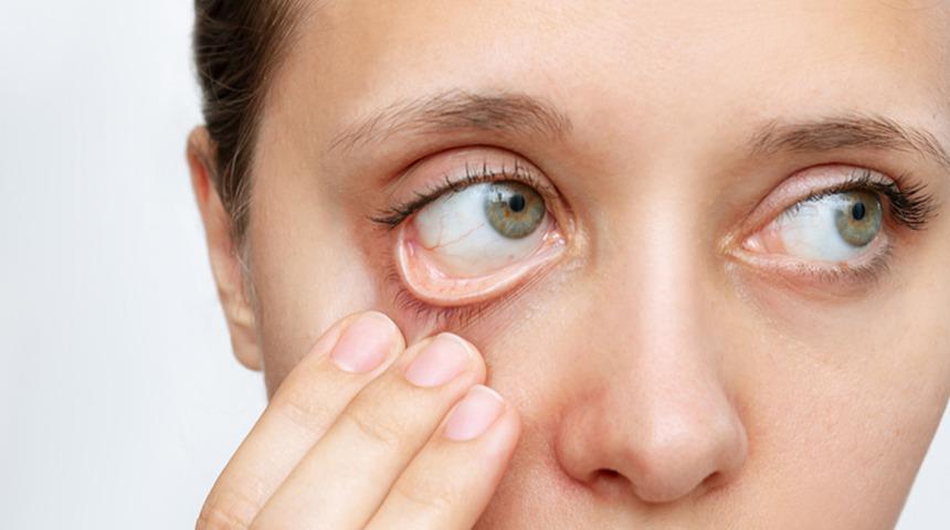 V&uuml;cudunuz bu vitamini &uuml;retemiyor! Eksikliği bakın nelere yol a&ccedil;ıyor