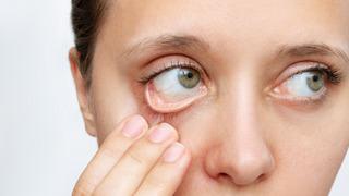 Vücudunuz bu vitamini üretemiyor! Eksikliği bakın nelere yol açıyor