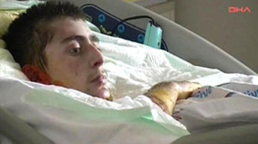 Eşek şakası &ouml;ld&uuml;rd&uuml;